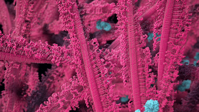 The animation depicts antibodies (blue) specifically targeting SNCA (α-Synuclein) protein aggregates